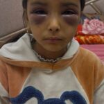 أهمية المقياس النفسية؟المقاييس النفسية ضرورية للتشخيص الدقيق